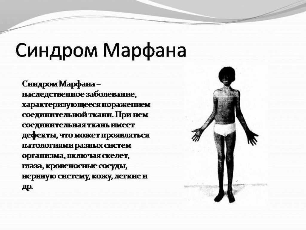 Патологии развития плода — аномалии развития конечностей: делайте вовремя узи