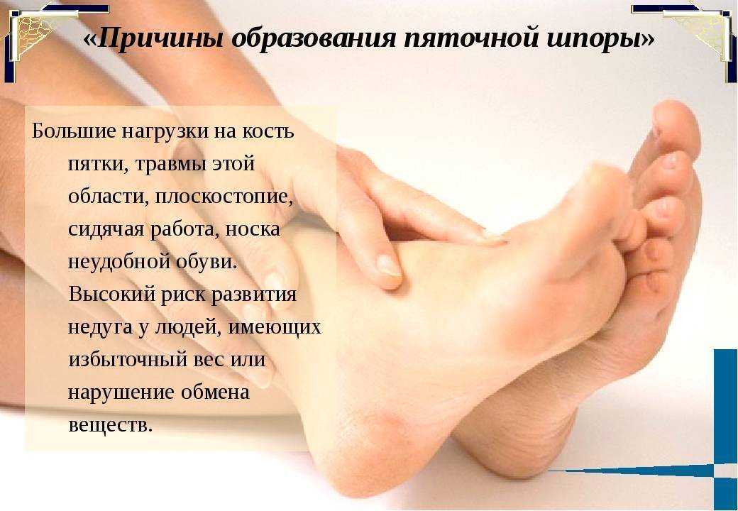 Терафозиды