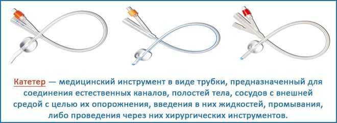 Инновационная модель эндотрахеального катетера (фэто-баллон) для эндоскопической окклюзии трахеи при тяжелой врожденной диафрагмальной грыже плода