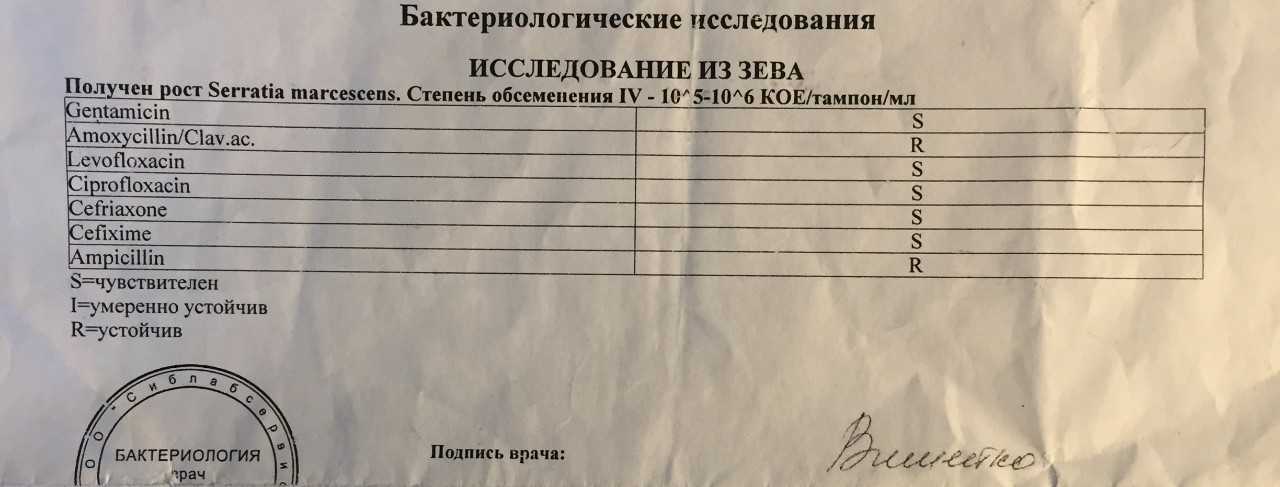 Зверек карбыш: фото, описание, среда обитания, вред и методы борьбы