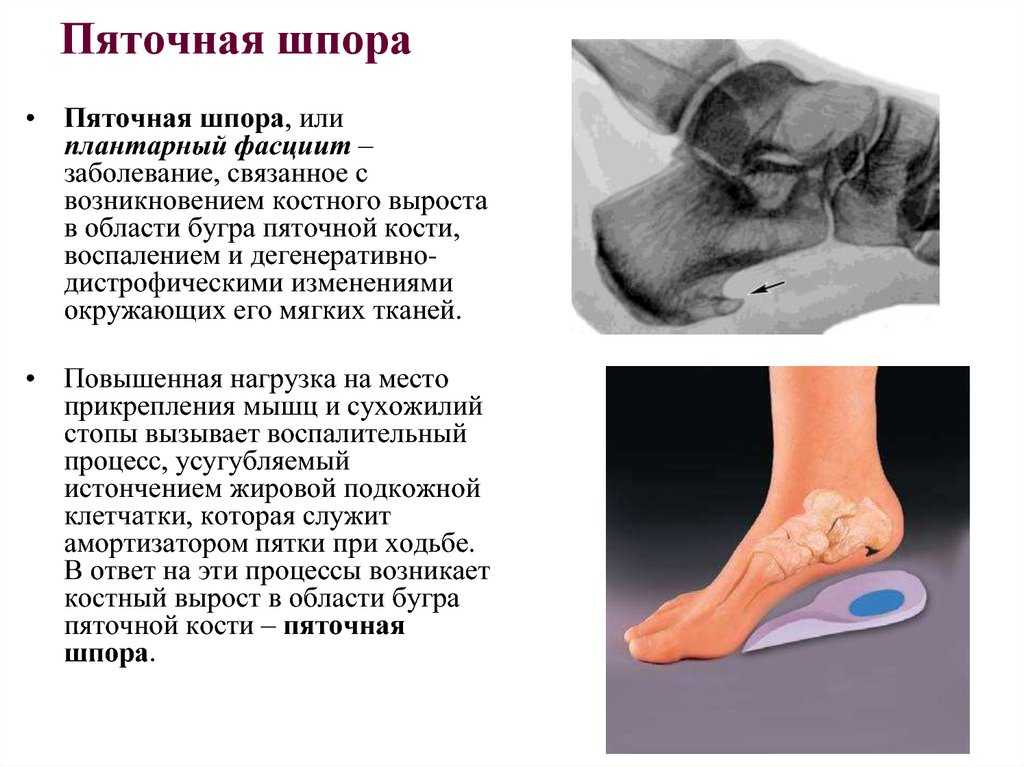Красный тигровый птицеед