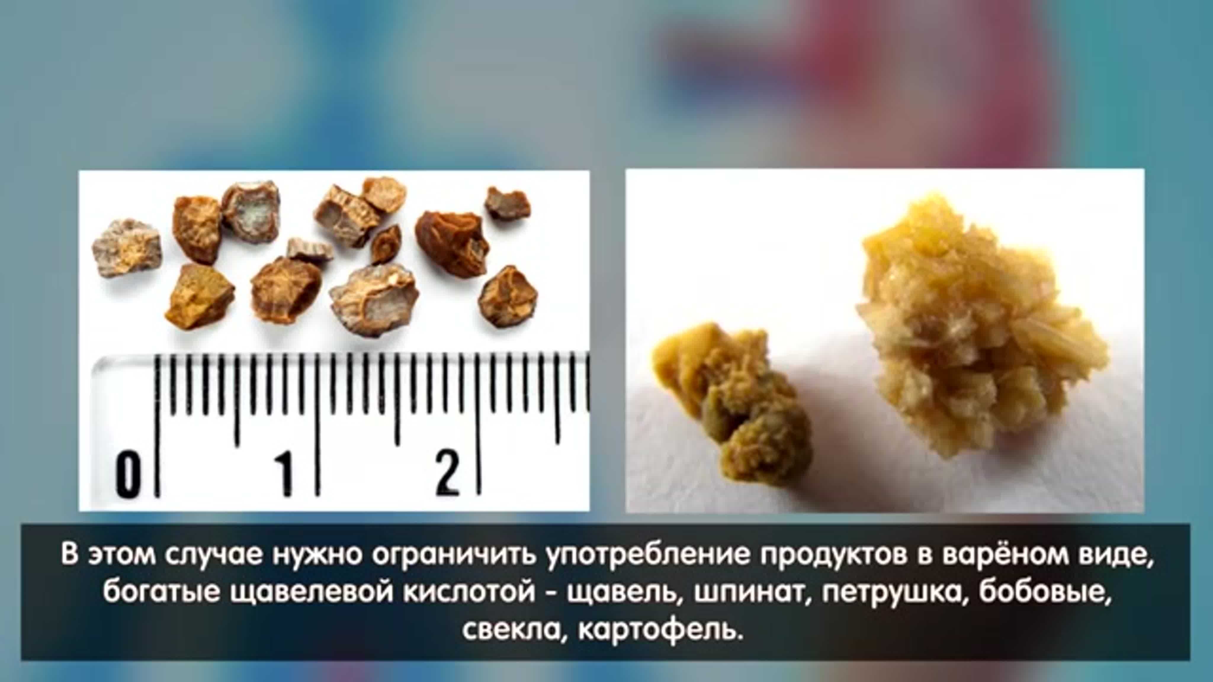 Зоонтарии - коралловидные | некоммерческий учебно-познавательный интернет-портал зоогалактика